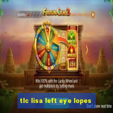 tlc lisa left eye lopes